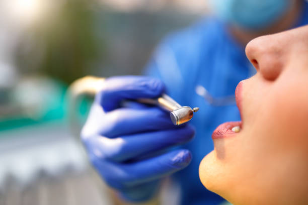 Best Teeth Whitening  in Mclean, TX